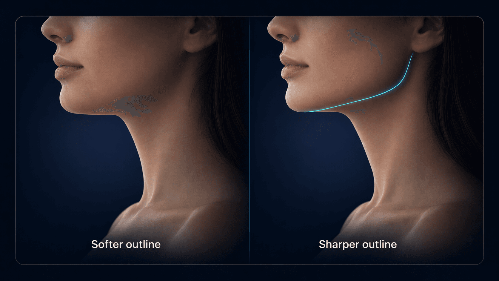 Comparison of soft vs defined jawline