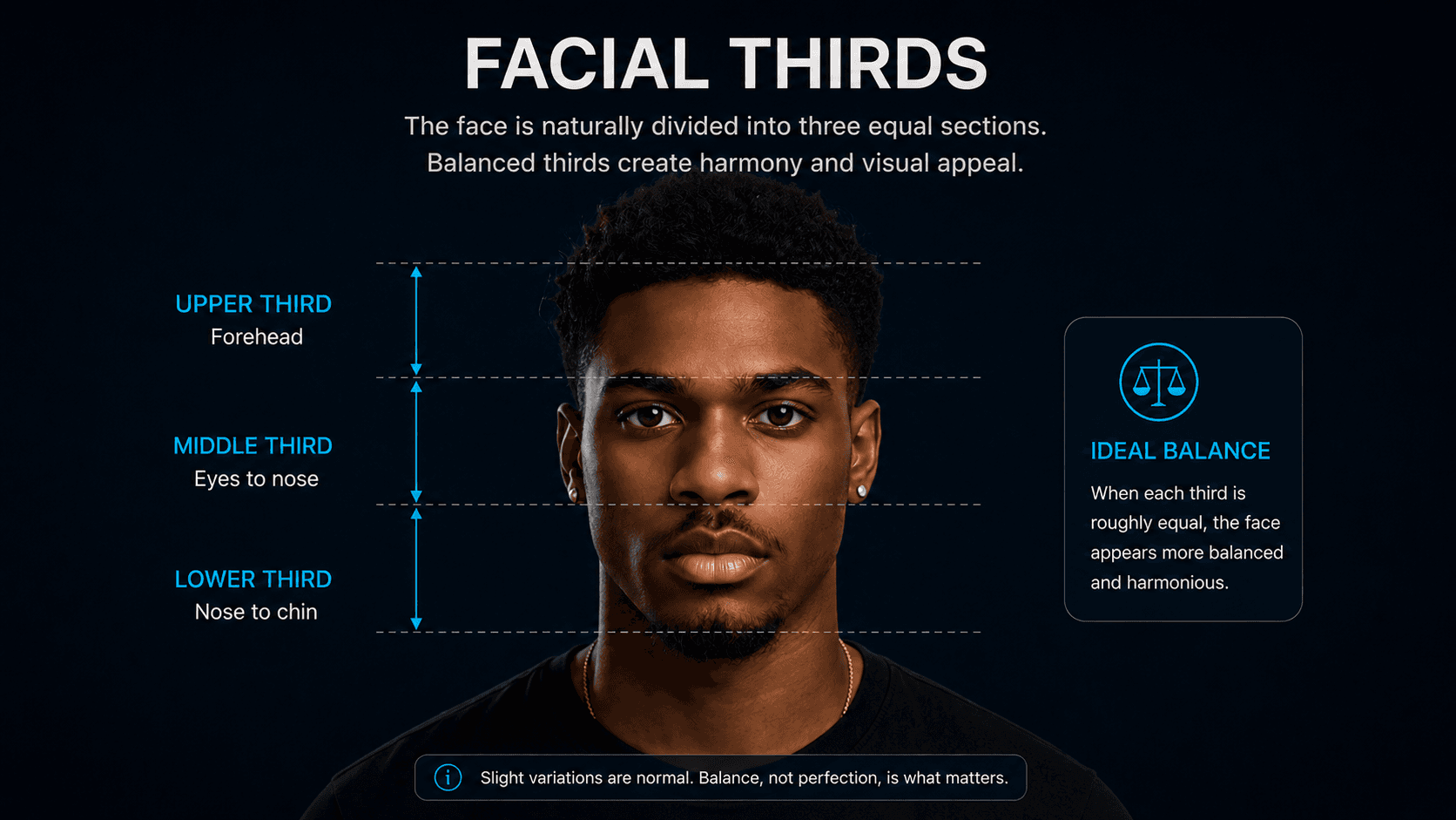 Diagram showing facial thirds divisions
