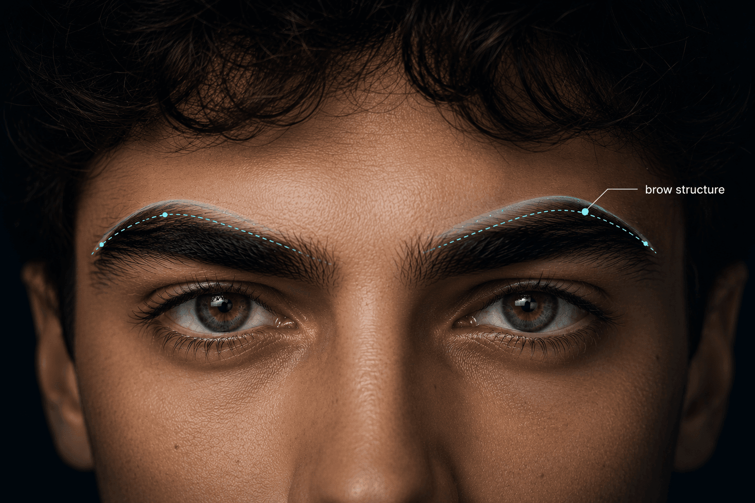 Brow support diagram
