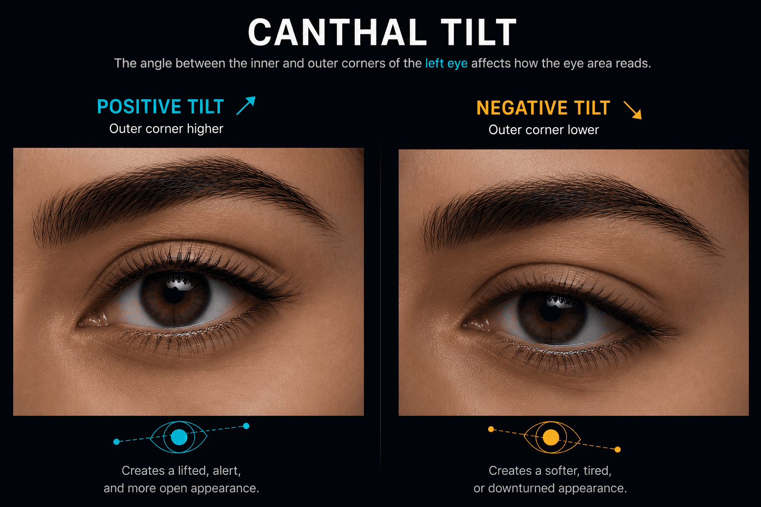 Canthal tilt diagram