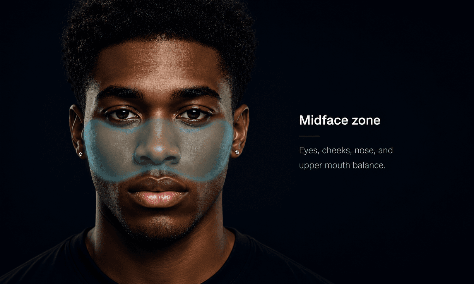 Midface zone diagram